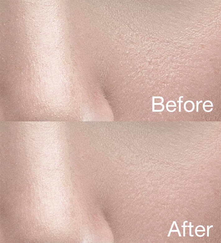 Fstoppers-Woloszynowicz-Smoothing-Skin-Texture-Before-After